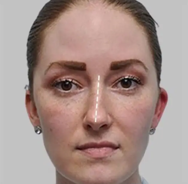 crooked nose