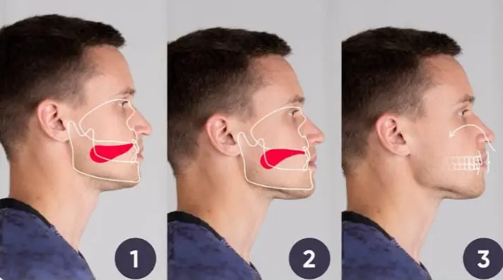 facial looksmaxing