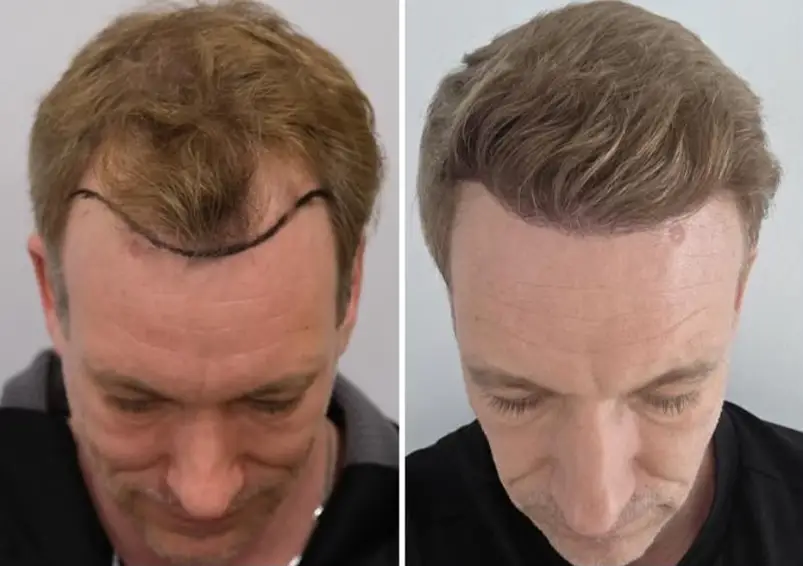 looksmax surgery