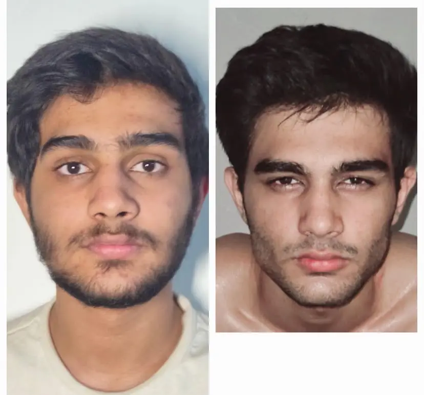 looksmaxing