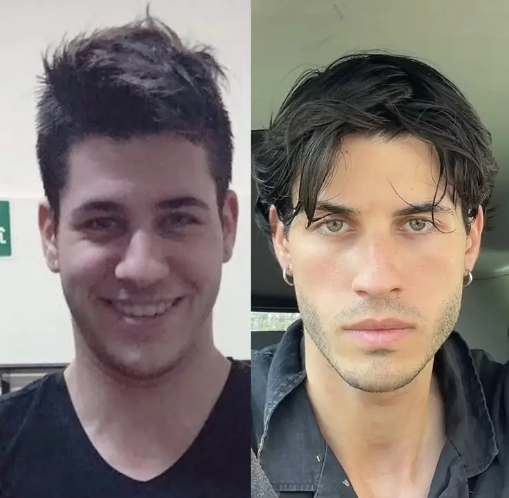 looksmaxing