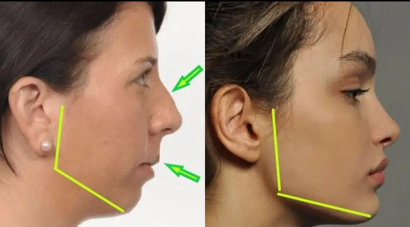 sinus looksmax