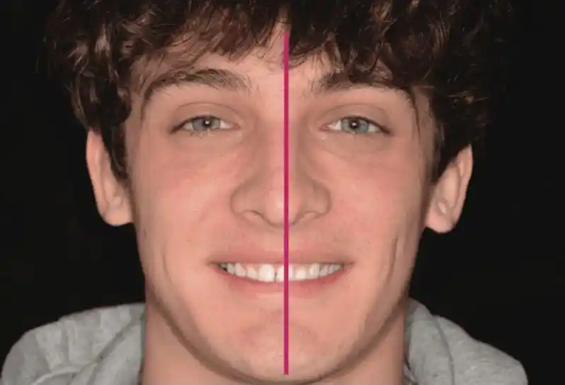 asymmetrical face