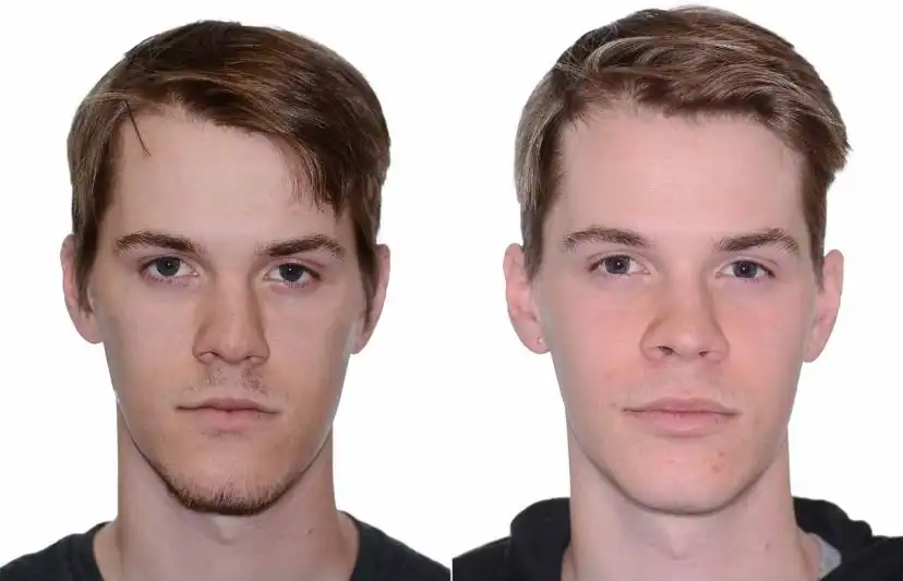 asymmetrical face