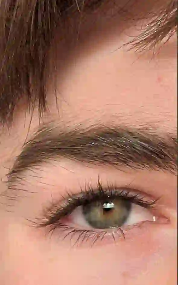 eye area