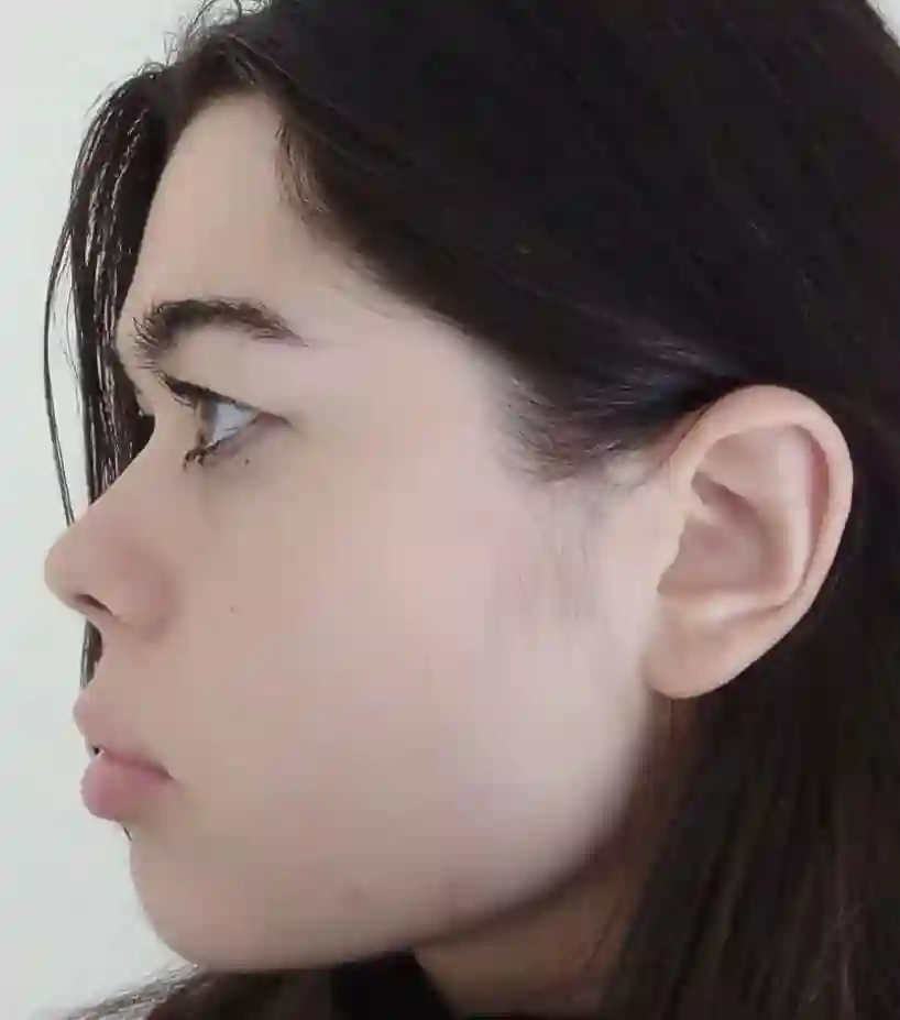upturned nose