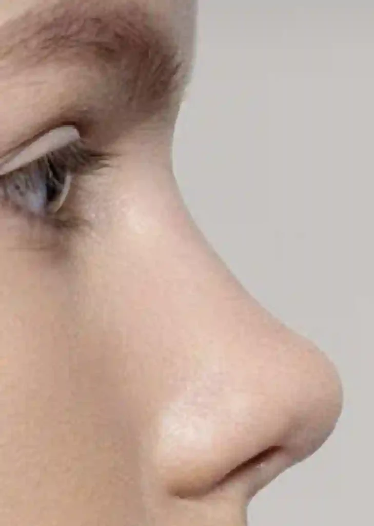 upturned nose